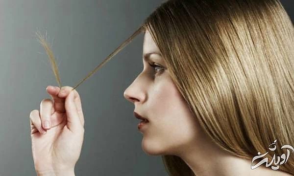 ترمیم موهای سوخته 
